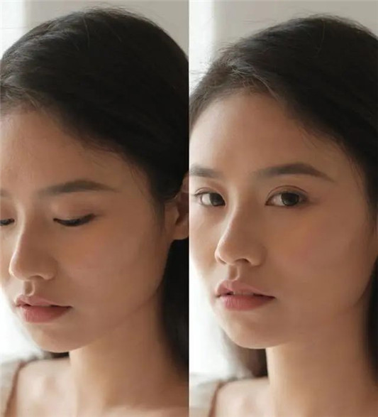 欧莱雅旗下赫莲娜系列30％玻色因的黑绷带值得买吗  欧莱雅 赫莲娜 值得买 第6张