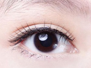 眼皮松弛做埋线的后果  眼皮松弛 美白祛黄 第4张