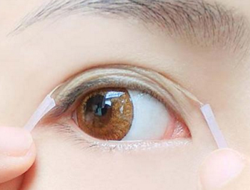 30岁上眼皮松弛怎么办，五种恢复紧致眼皮  眼皮松弛 30岁 美白祛黄 第5张