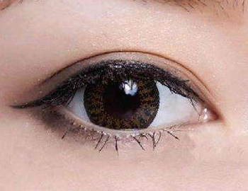 切眉和做双眼皮哪个好，眼部整形大对比  切眉 做双眼皮 美白祛黄 第2张