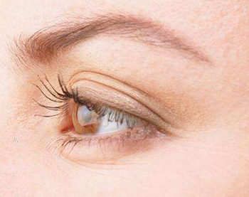 切眉和做双眼皮哪个好，眼部整形大对比  切眉 做双眼皮 美白祛黄 第3张