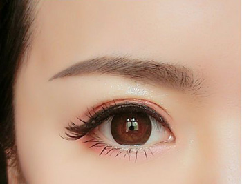 做切眉手术后的注意事项，必须注意的5点