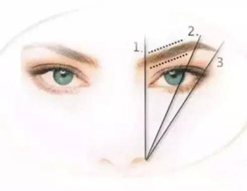 做切眉手术后的注意事项，必须注意的5点  注意事项 切眉手术 美白祛黄 第4张