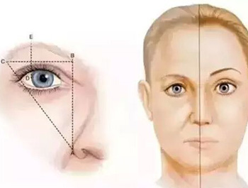 为什么切眉手术后老的快，正确使用切眉手术  切眉手术 美白祛黄 第4张