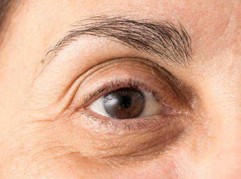 眼袋下垂怎么消除效果好，学会4种方法缓解