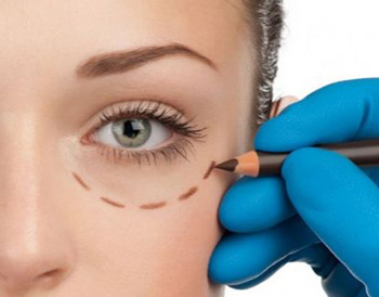 去眼袋手术有什么风险和危害  去眼袋 风险 美白祛黄 第3张