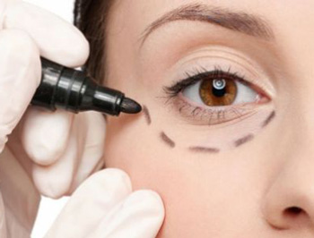 去眼袋手术有什么风险和危害  去眼袋 风险 美白祛黄 第5张