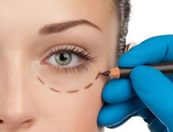 最先进的去眼袋方法，对比分析5种  去眼袋 美白祛黄 第4张