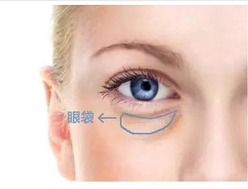 超声波去眼袋靠谱吗，注意事项