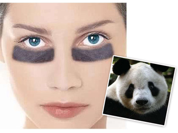 黑眼圈很重是什么病，必须知道的4种