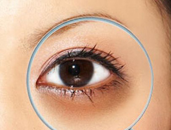 黑眼圈很重是什么病，必须知道的4种  黑眼圈 美白祛黄 第2张