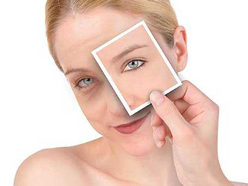 黑眼圈很重是什么病，必须知道的4种  黑眼圈 美白祛黄 第3张