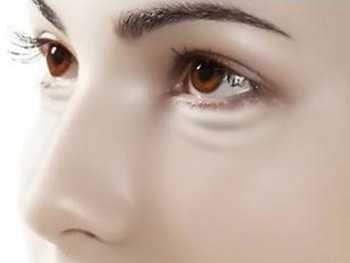 激光去黑眼圈有什么伤害，必须了解的5种  黑眼圈 激光 美白祛黄 第4张