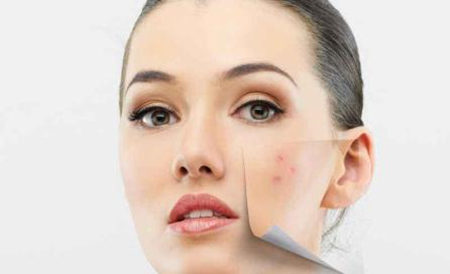 敏感痘肌如何有效祛痘无刺激，一位六年痘敏史小仙女忠告