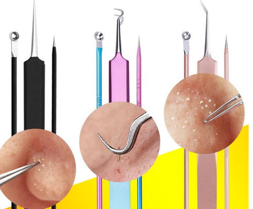 挑完粉刺后怎么消炎，几个消炎方法可参考