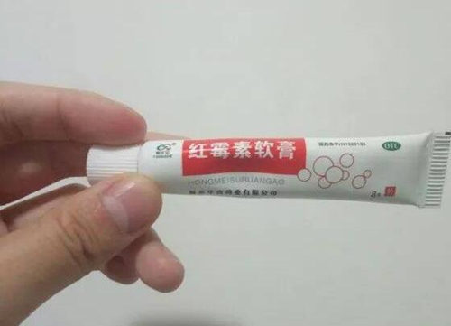 挑完粉刺后怎么消炎，几个消炎方法可参考  粉刺 消炎 美白祛黄 第3张