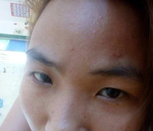 干性皮肤为什么会长痘，怎么办  干性皮肤 美白祛黄 第2张