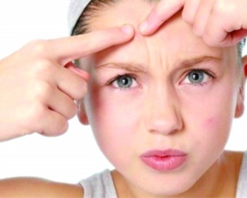 有脓的痘痘如何处理，脓包型痘痘处理方法  痘痘 脓包 方法 美白祛黄 第3张