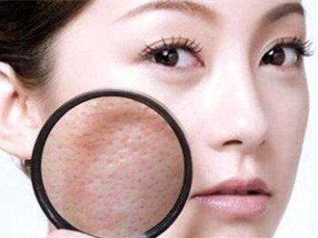 怎么判断脸上有螨虫，五个方法好判断  螨虫 美白祛黄 第3张