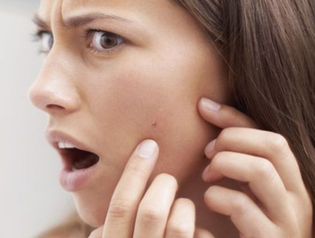 用护肤品爆痘是排毒吗，怎么办