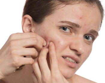 脂肪粒跟粉刺的区别，教你区分脂肪粒与闭口  脂肪粒 粉刺 美白祛黄 第2张