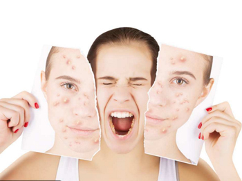 脂肪粒跟粉刺的区别，教你区分脂肪粒与闭口  脂肪粒 粉刺 美白祛黄 第3张