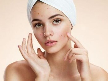 什么年龄会不再长痘痘，祛痘不能等