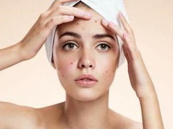 脸上有炎症痘痘怎么处理，日常护理小方法