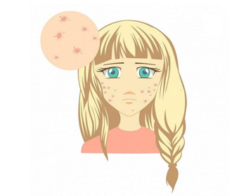 如何快速5分钟内消痘，五分钟祛痘真实性