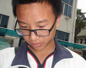 青春痘什么年龄会消失，青春痘的起承转合  青春痘 年龄 美白祛黄 第2张