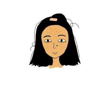 青春痘什么年龄会消失，青春痘的起承转合  青春痘 年龄 美白祛黄 第3张