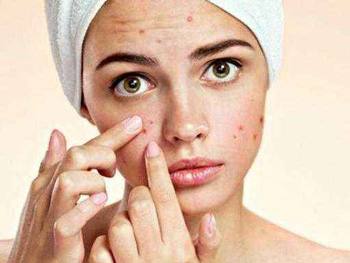 换季长痘痘什么原因持续多久，怎么办