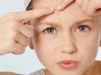 换季长痘痘什么原因持续多久,怎么办 换季长痘 美白祛黄 第2张 换季长痘痘什么原因持续多久,怎么办 换季长痘 美白祛黄 第2张