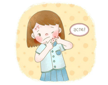 冬天起痘痘是怎么回事，教你不一到冬天就长痘