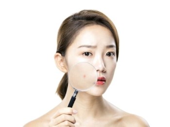 水杨酸能祛痘吗，祛痘要小心