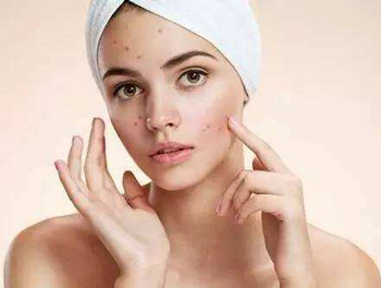 痘痘肌可以用爽肤水吗，推荐3款