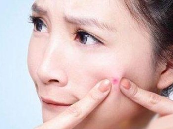 闭口爆痘好不好、怎么办，正确对待闭口变痘痘