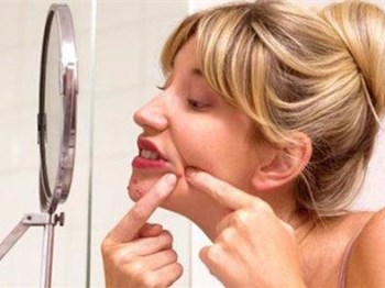 闭**痘好不好、怎么办，正确对待闭口变痘痘  怎么办 美白祛黄 第4张