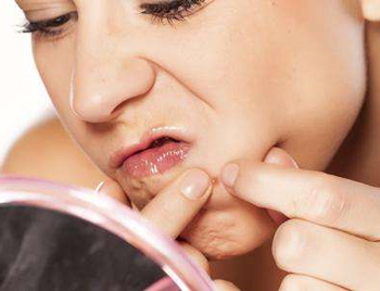 闭合性粉刺挤掉好还是不挤好  闭合性粉刺 美白祛黄 第2张