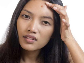 更年期长痘痘的原因，如何调理  更年期长痘 美白祛黄 第4张