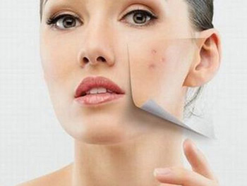 脸干长痘痘是什么原因，怎么办