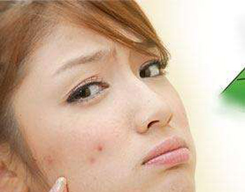 脸干长痘痘是什么原因，怎么办  脸干长痘 美白祛黄 第4张