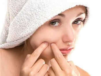 脸干长痘痘是什么原因，怎么办  脸干长痘 美白祛黄 第5张