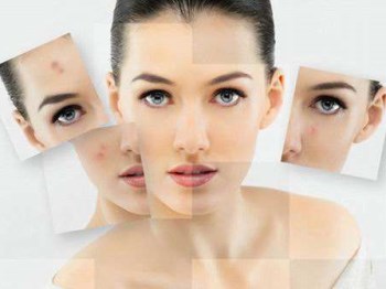 油性皮肤长痘痘怎么调理，祛痘先学会护肤