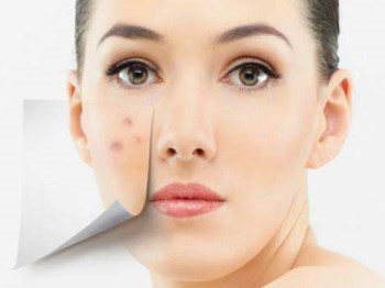 三十多岁脸上长痘什么原因怎么办