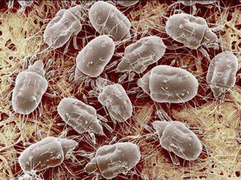 胸前长痘痘是什么原因，分析5种常见情况  长痘的原因 美白祛黄 第2张