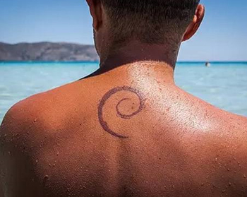 后背长闭合性粉刺，后背粉刺详情解析  粉刺 后背 闭合性 美白祛黄 第2张