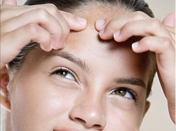 额头长痘痘什么原因，六种原因你了解吗  痘痘 额头 原因 美白祛黄 第6张