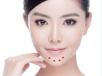 为什么下巴总是长痘痘，具体原因具体分析  痘痘 下巴 美白祛黄 第4张