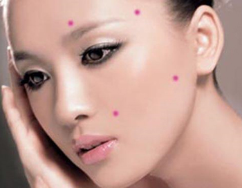 腮两侧长痘频繁的原因，两腮长痘原因大解析  原因 腮两侧 美白祛黄 第4张